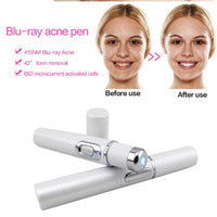 Thumbnail for Blue Light Therapy Acne Laser Pen Soft Scar Wrinkle Removal Treatment Device Skin Care Beauty Equipment